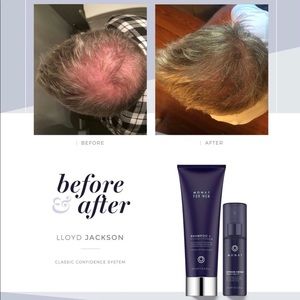 Monat Vegan Classic Confidence System Hair Growth